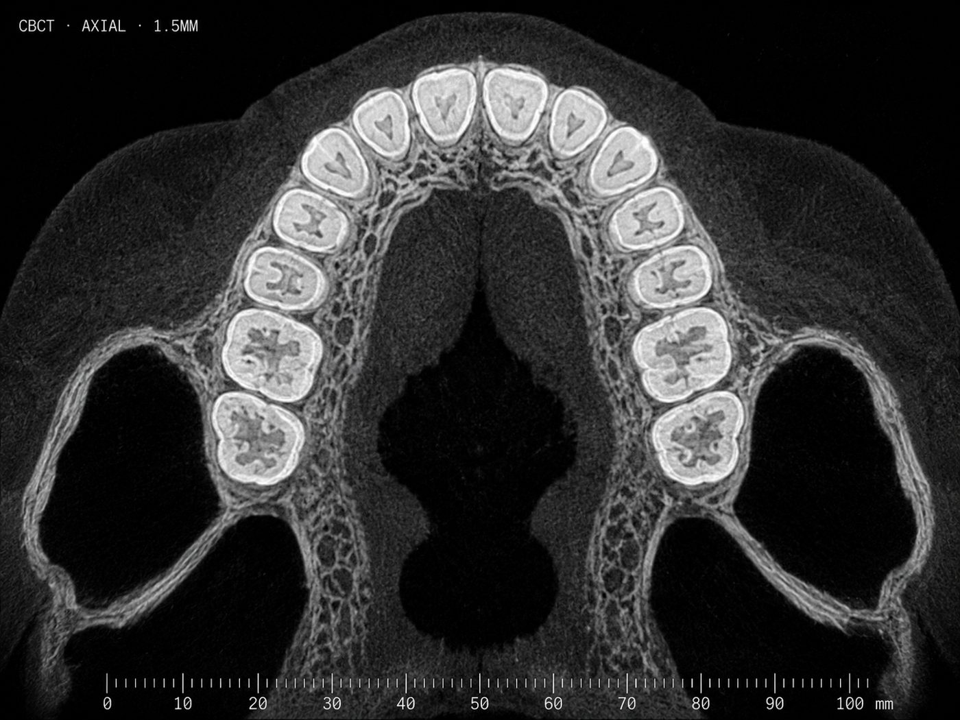 CBCT axial slice of a dental arch the designer works from