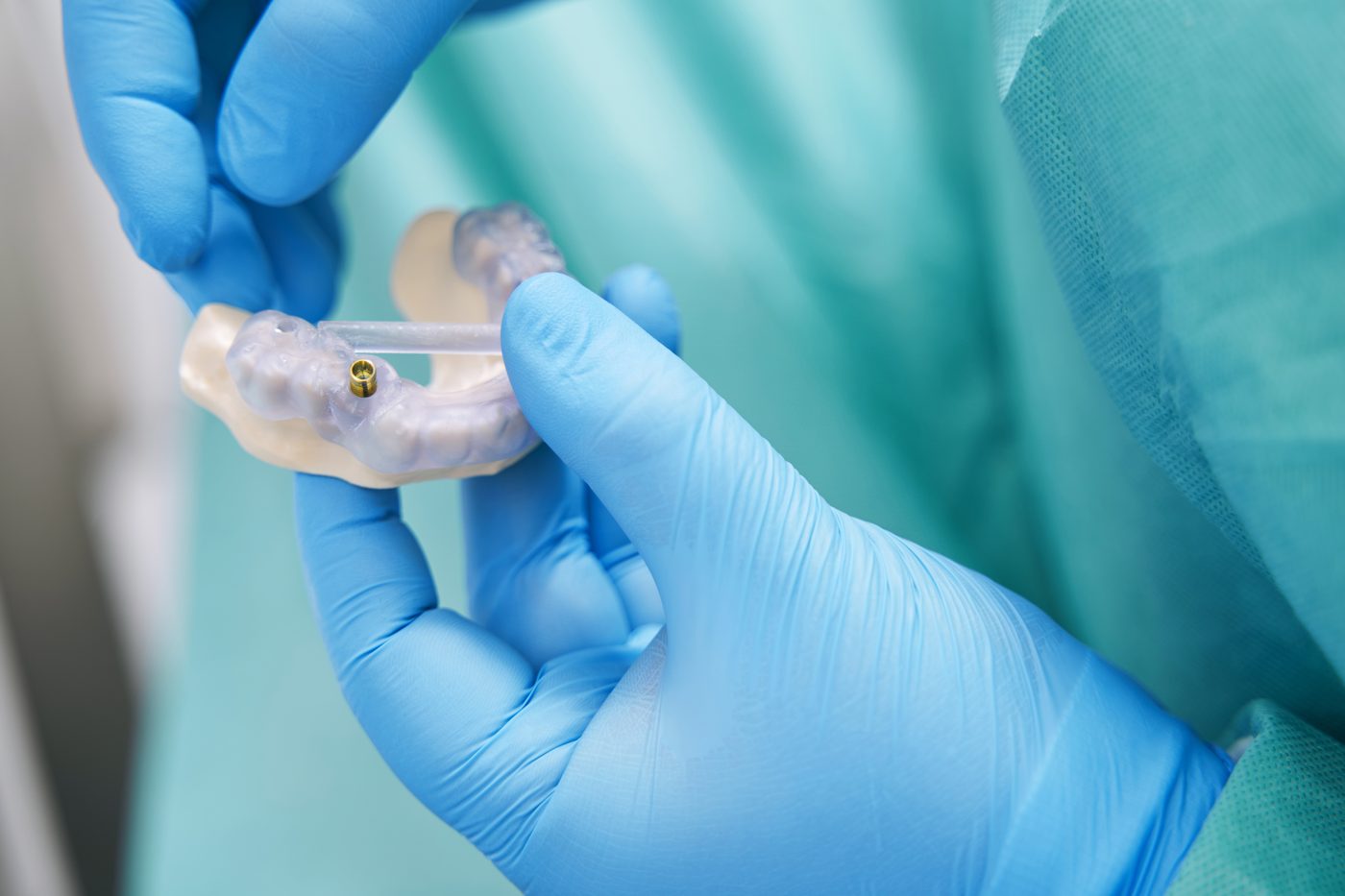 A surgeon in sterile gloves holding a printed surgical guide with a guide sleeve