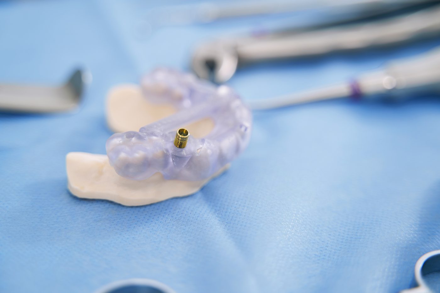 Implant components