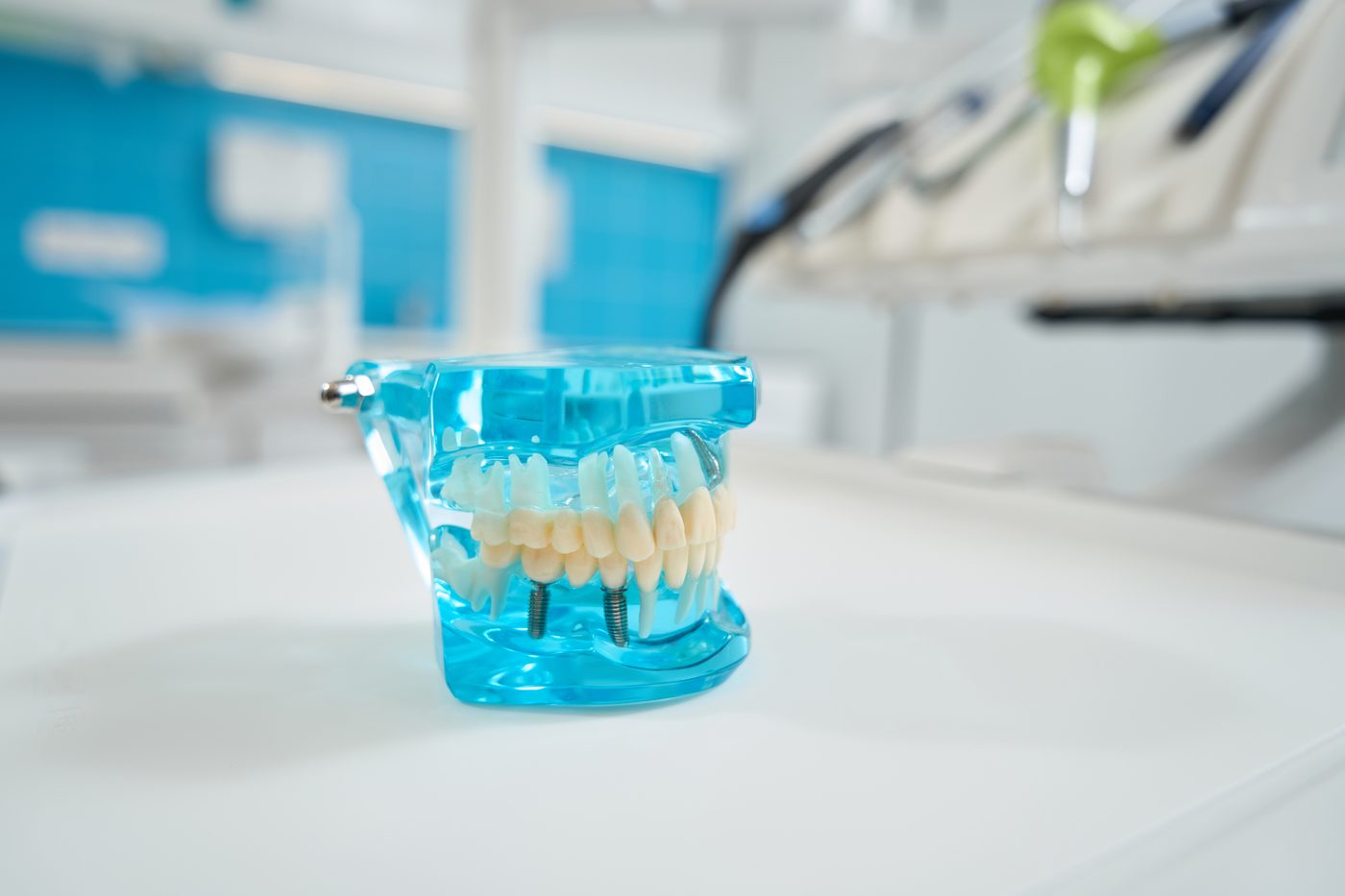 Implant study model